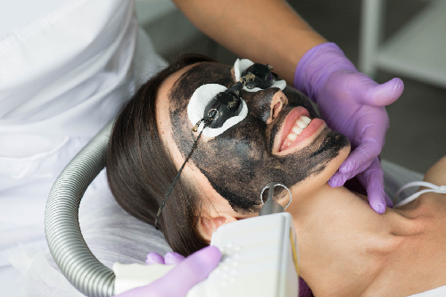 Carbon Peeling — High Standard Laser