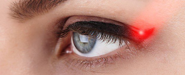 Eyeliner PMU Removal